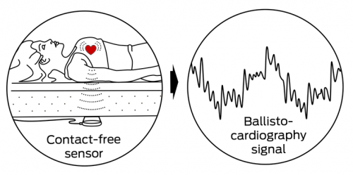 Ballistocardiography
